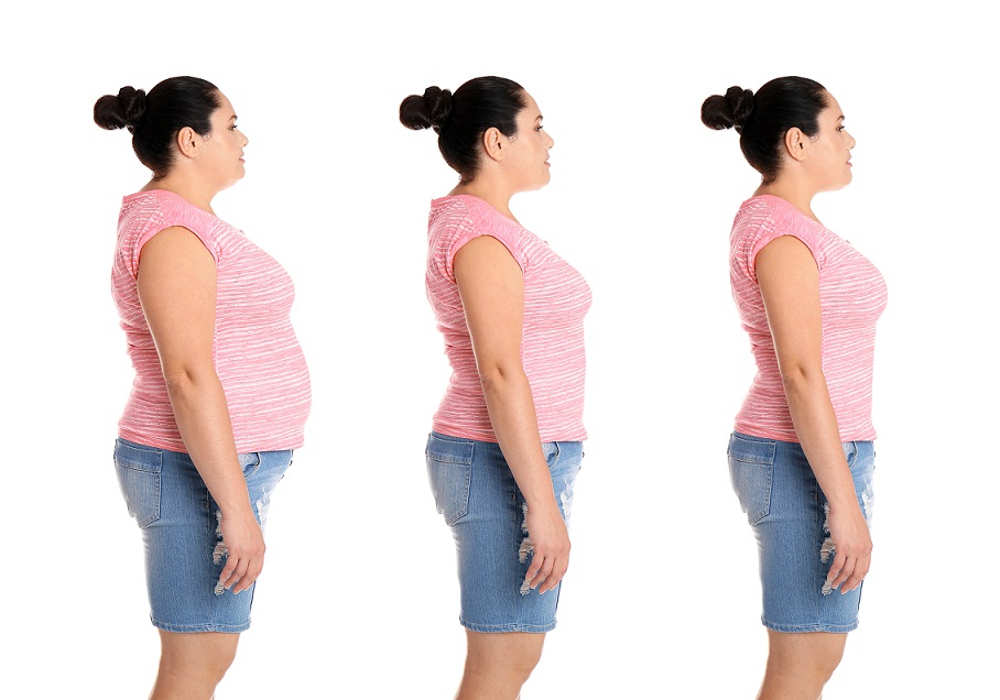 Fat Dissolving Injections Price in Pakistan