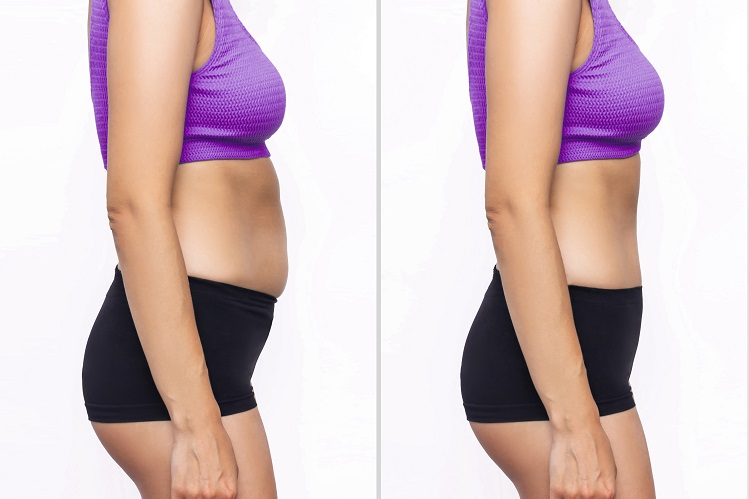 Fat Dissolving Injections Price in Pakistan